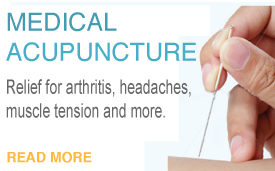 Acupuncture Treatment